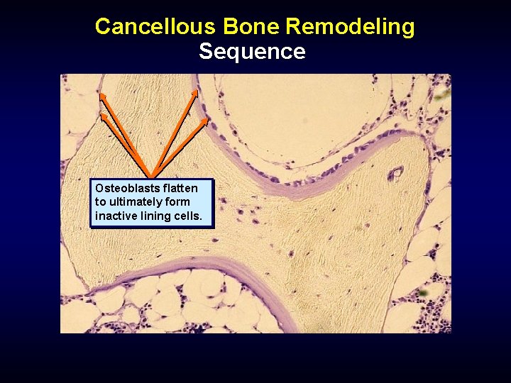 Cancellous Bone Remodeling Sequence Osteoblasts flatten to ultimately form inactive lining cells. 