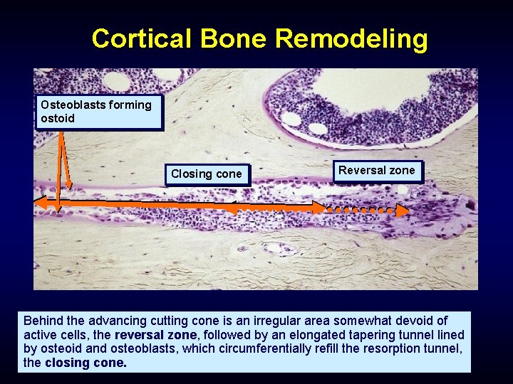 Cortical Bone Remodeling Osteoblasts forming ostoid Closing cone Reversal zone Behind the advancing cutting