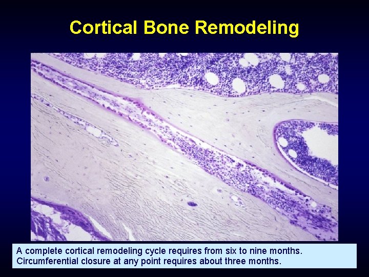 Cortical Bone Remodeling A complete cortical remodeling cycle requires from six to nine months.