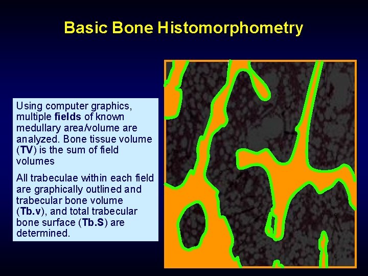 Basic Bone Histomorphometry Using computer graphics, multiple fields of known medullary area/volume are analyzed.