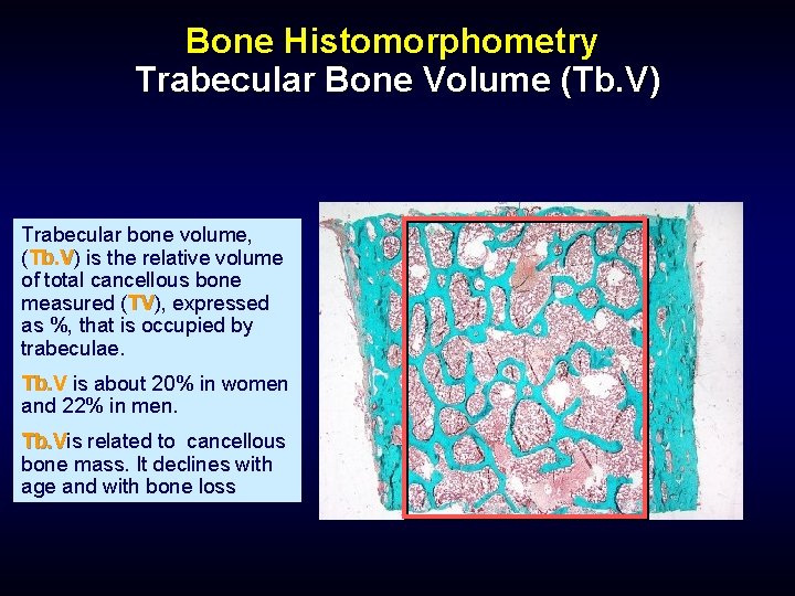 Bone Histomorphometry Trabecular Bone Volume (Tb. V) Trabecular bone volume, (Tb. V) Tb. V
