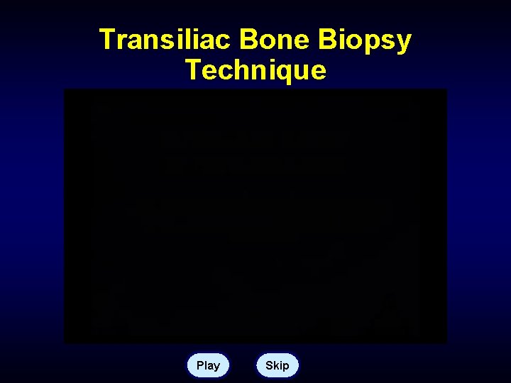 Transiliac Bone Biopsy Technique Play Skip 