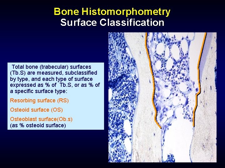 Bone Histomorphometry Surface Classification Total bone (trabecular) surfaces (Tb. S) are measured, subclassified by