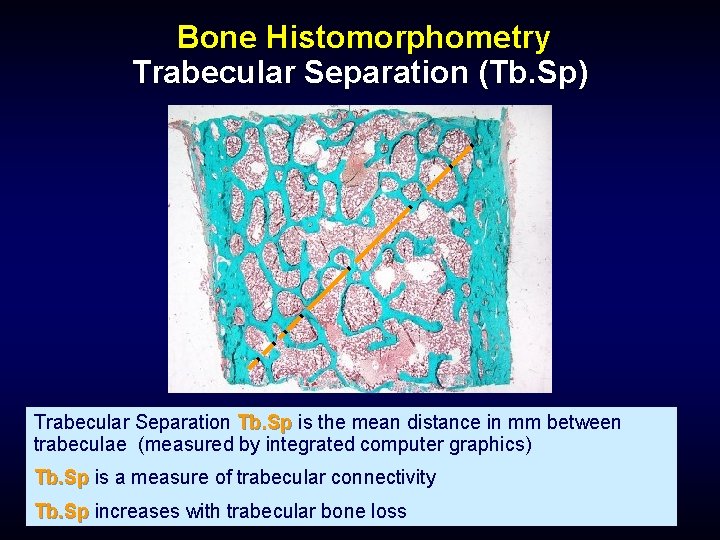 Bone Histomorphometry Trabecular Separation (Tb. Sp) Trabecular Separation Tb. Sp is the mean distance