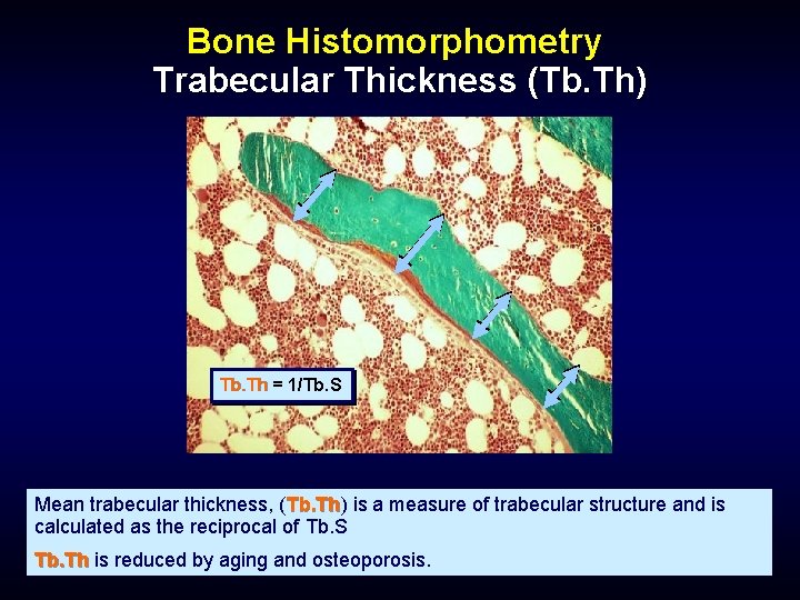 Bone Histomorphometry Trabecular Thickness (Tb. Th) Tb. Th = 1/Tb. S Mean trabecular thickness,