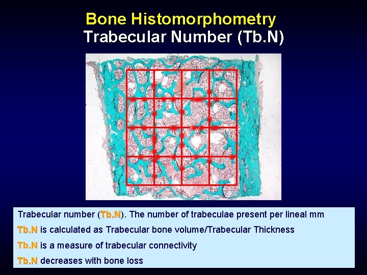 Bone Histomorphometry Trabecular Number (Tb. N) Trabecular number (Tb. N). Tb. N The number