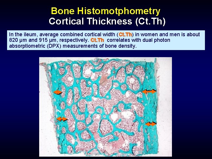 Bone Histomotphometry Cortical Thickness (Ct. Th) In the ileum, average combined cortical width (Ct.