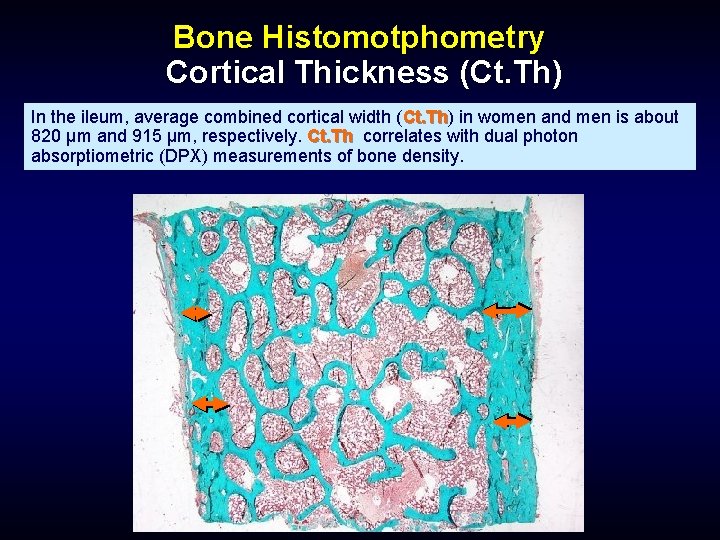 Bone Histomotphometry Cortical Thickness (Ct. Th) In the ileum, average combined cortical width (Ct.