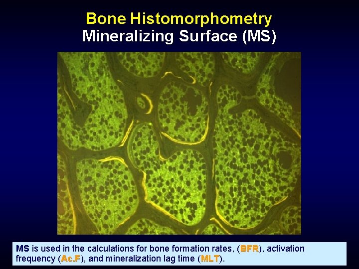 Bone Histomorphometry Mineralizing Surface (MS) MS is used in the calculations for bone formation
