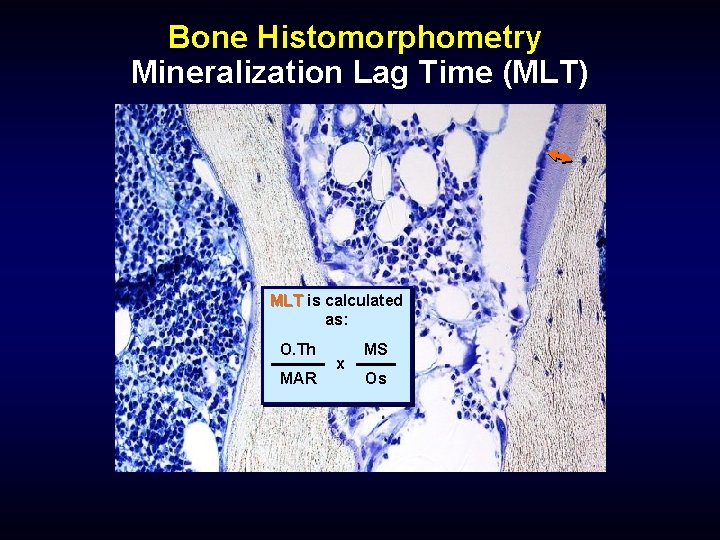 Bone Histomorphometry Mineralization Lag Time (MLT) MLT is calculated as: O. Th MAR x