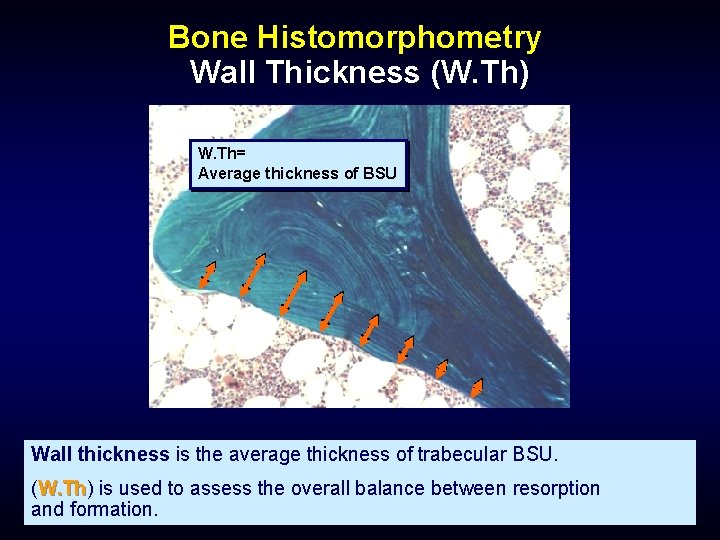 Bone Histomorphometry Wall Thickness (W. Th) W. Th= Average thickness of BSU Wall thickness