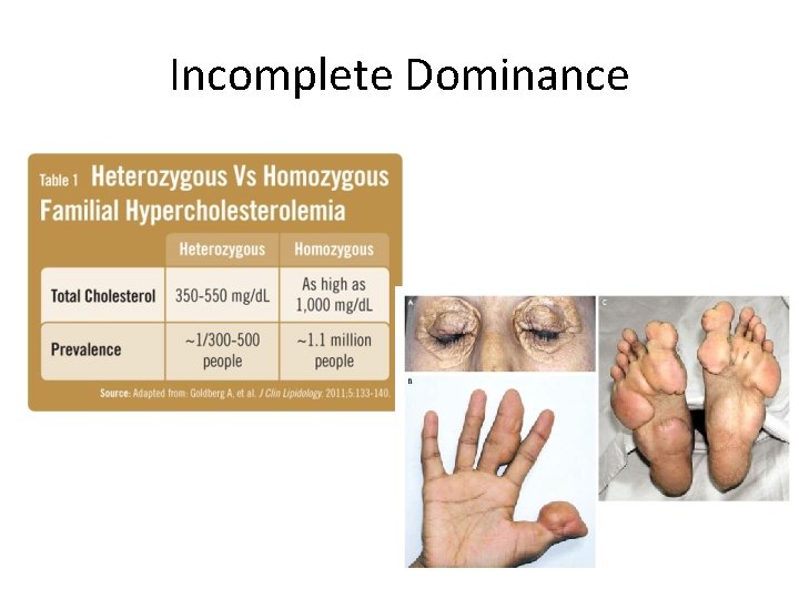 Incomplete Dominance 