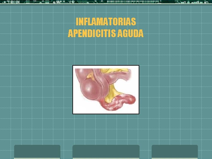 INFLAMATORIAS APENDICITIS AGUDA 