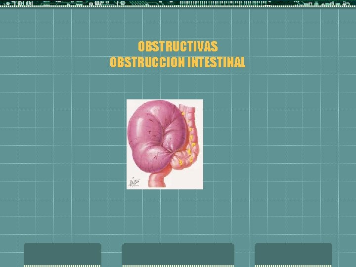 OBSTRUCTIVAS OBSTRUCCION INTESTINAL 