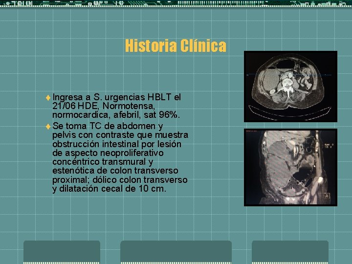 Historia Clínica t Ingresa a S. urgencias HBLT el 21/06 HDE, Normotensa, normocardica, afebril,