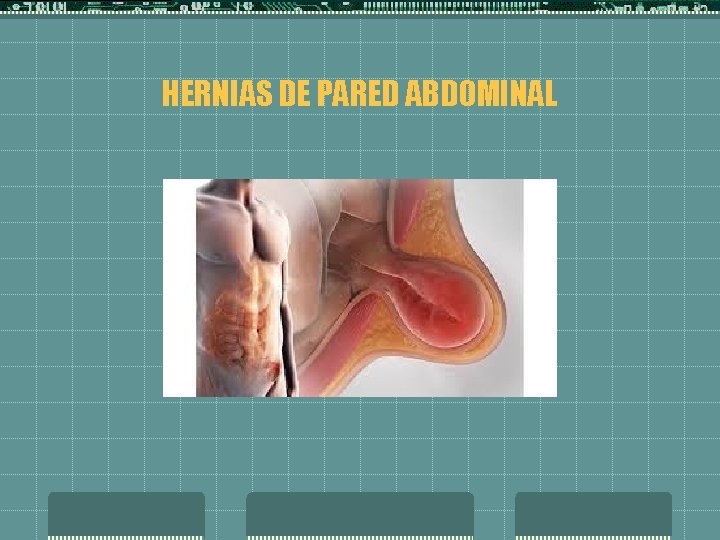 HERNIAS DE PARED ABDOMINAL 