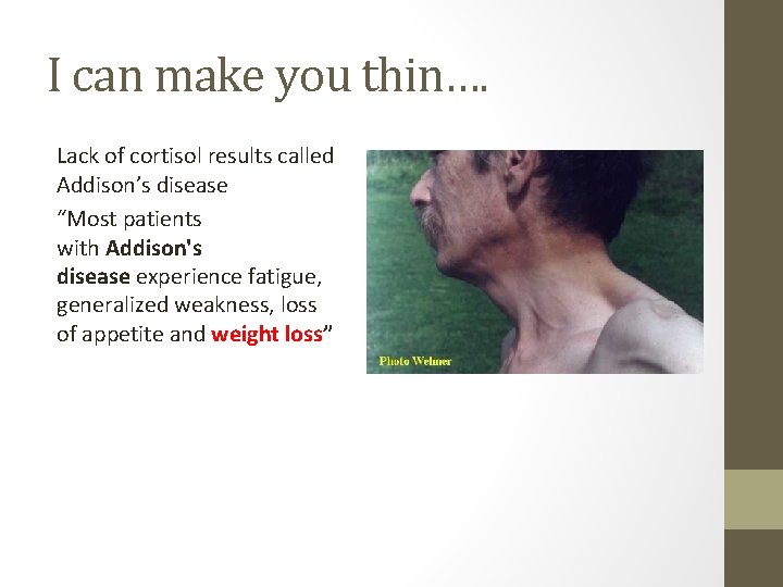 I can make you thin…. Lack of cortisol results called Addison’s disease “Most patients