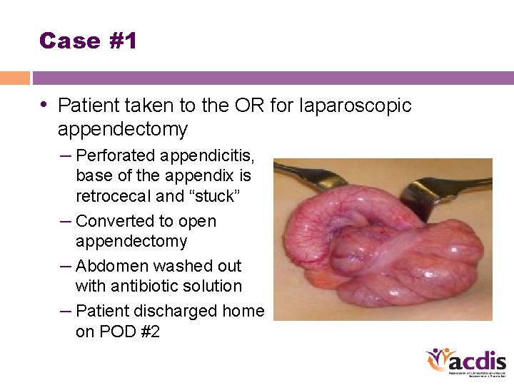 Case #1 • Patient taken to the OR for laparoscopic appendectomy – Perforated appendicitis,