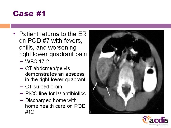 Case #1 • Patient returns to the ER on POD #7 with fevers, chills,