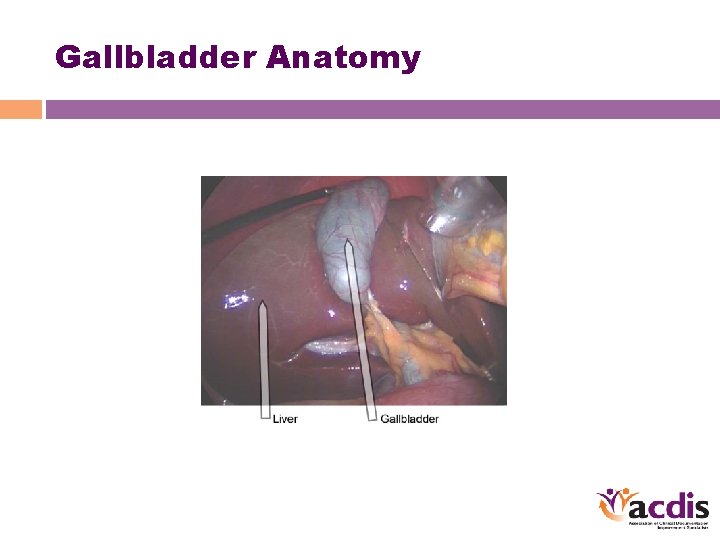 Gallbladder Anatomy 