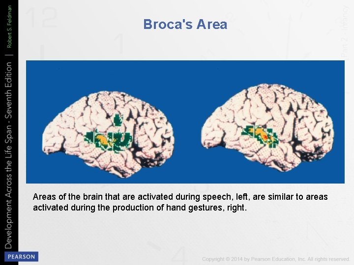 Broca's Areas of the brain that are activated during speech, left, are similar to