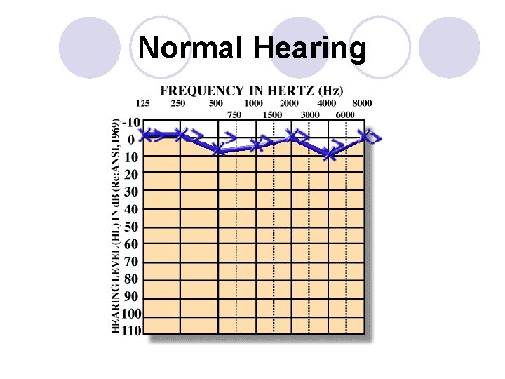 Normal Hearing 