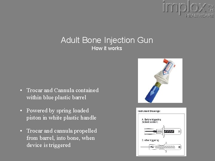 Adult Bone Injection Gun How it works • Trocar and Cannula contained within blue