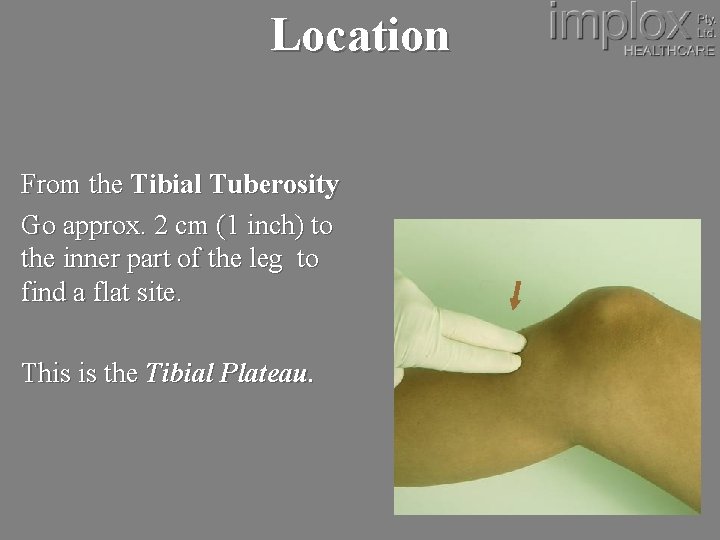 Location From the Tibial Tuberosity Go approx. 2 cm (1 inch) to the inner