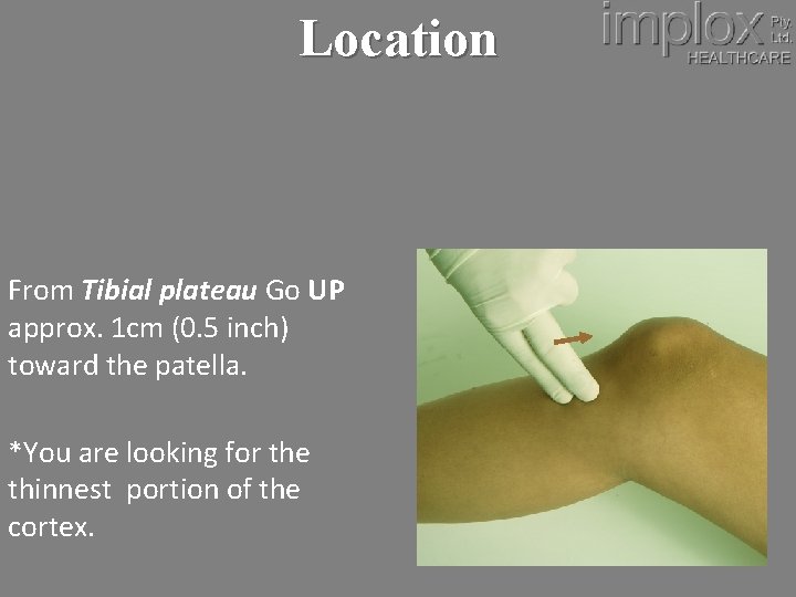 Location From Tibial plateau Go UP approx. 1 cm (0. 5 inch) toward the