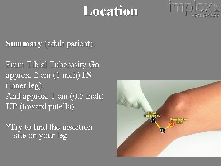 Location Summary (adult patient): From Tibial Tuberosity Go approx. 2 cm (1 inch) IN