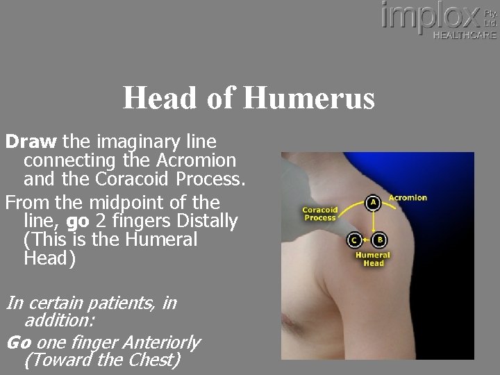 Head of Humerus Draw the imaginary line connecting the Acromion and the Coracoid Process.