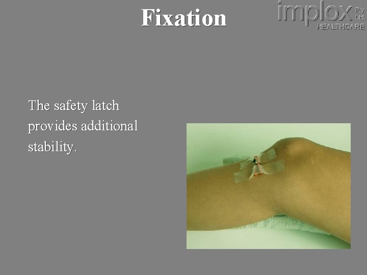 Fixation The safety latch provides additional stability. 
