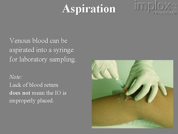 Aspiration Venous blood can be aspirated into a syringe for laboratory sampling. Note: Lack