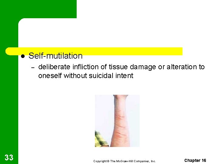 l Self-mutilation – 33 deliberate infliction of tissue damage or alteration to oneself without