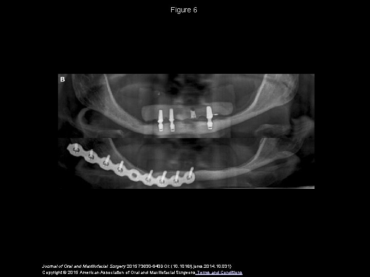 Figure 6 Journal of Oral and Maxillofacial Surgery 2015 73630 -640 DOI: (10. 1016/j.