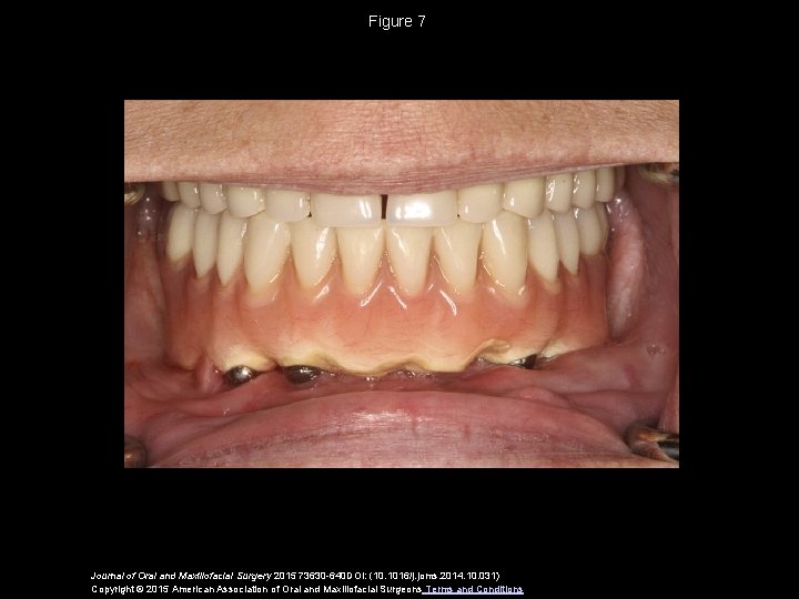 Figure 7 Journal of Oral and Maxillofacial Surgery 2015 73630 -640 DOI: (10. 1016/j.