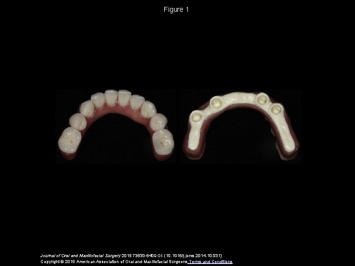 Figure 1 Journal of Oral and Maxillofacial Surgery 2015 73630 -640 DOI: (10. 1016/j.