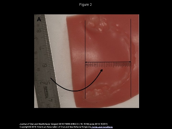 Figure 2 Journal of Oral and Maxillofacial Surgery 2015 73630 -640 DOI: (10. 1016/j.