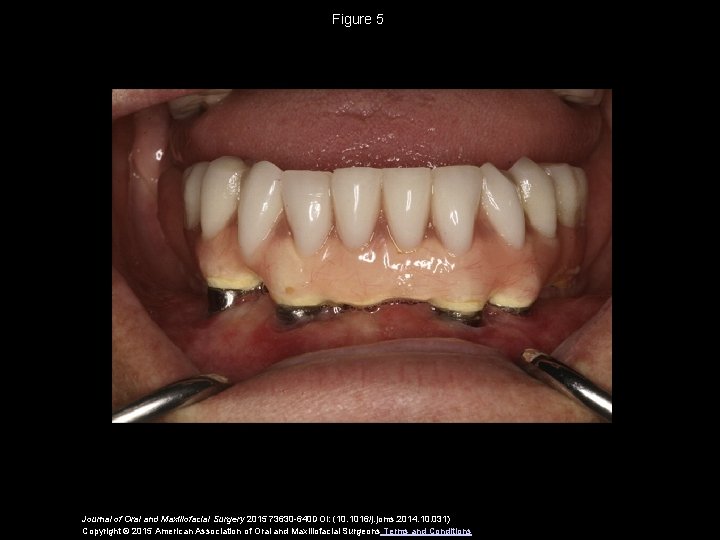 Figure 5 Journal of Oral and Maxillofacial Surgery 2015 73630 -640 DOI: (10. 1016/j.