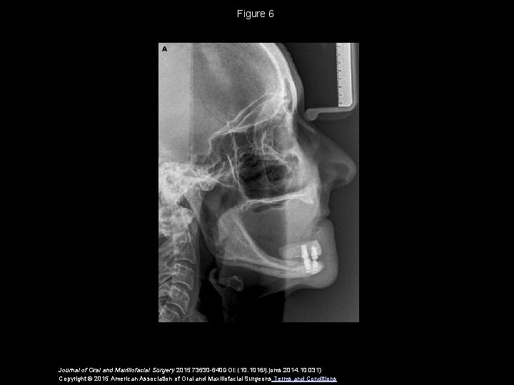 Figure 6 Journal of Oral and Maxillofacial Surgery 2015 73630 -640 DOI: (10. 1016/j.