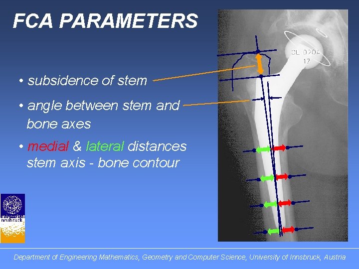 FCA PARAMETERS • subsidence of stem • angle between stem and bone axes •
