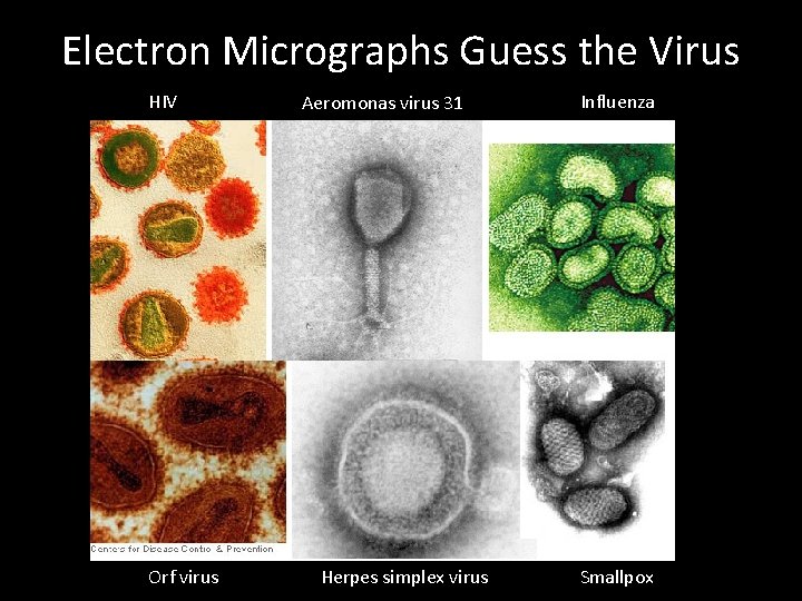Electron Micrographs Guess the Virus HIV Orf virus Aeromonas virus 31 Herpes simplex virus