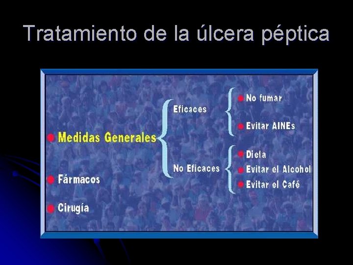 Tratamiento de la úlcera péptica 