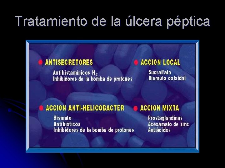 Tratamiento de la úlcera péptica 