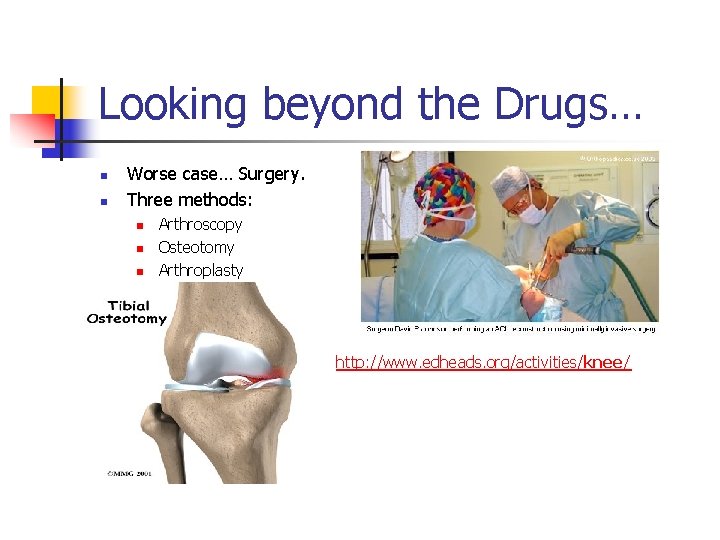 Looking beyond the Drugs… n n Worse case… Surgery. Three methods: n n n