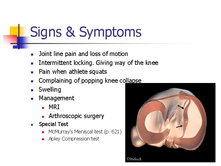 Signs & Symptoms n n n n Joint line pain and loss of motion