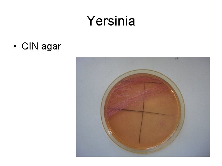 Yersinia • CIN agar 