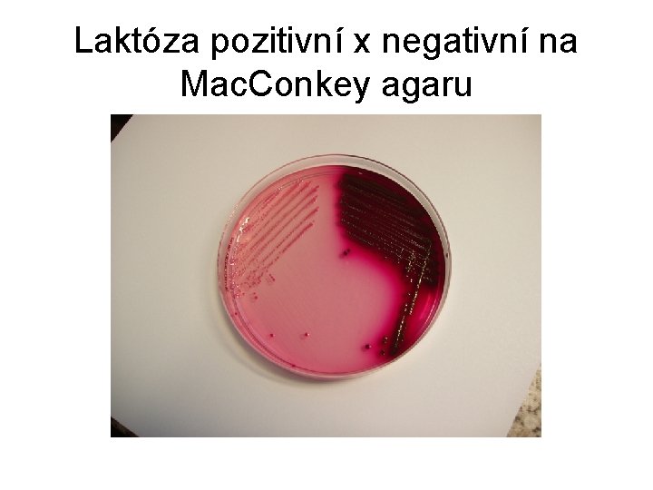 Laktóza pozitivní x negativní na Mac. Conkey agaru 