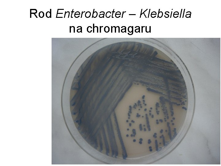 Rod Enterobacter – Klebsiella na chromagaru 