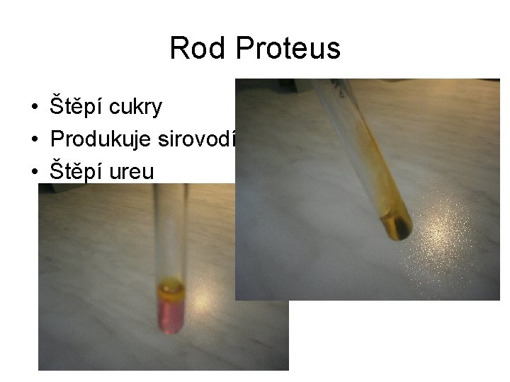 Rod Proteus • Štěpí cukry • Produkuje sirovodík • Štěpí ureu 